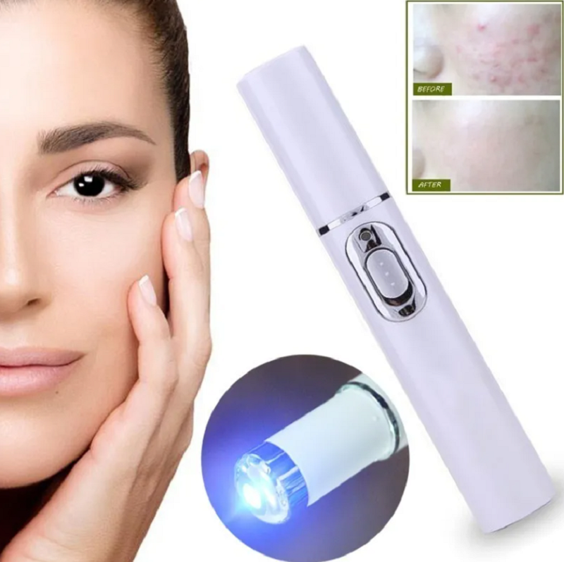 Lápiz Láser Terapia de Luz Azul Elimina Acné, Manchas , Cicatrices y Rejuvenece Tu Piel